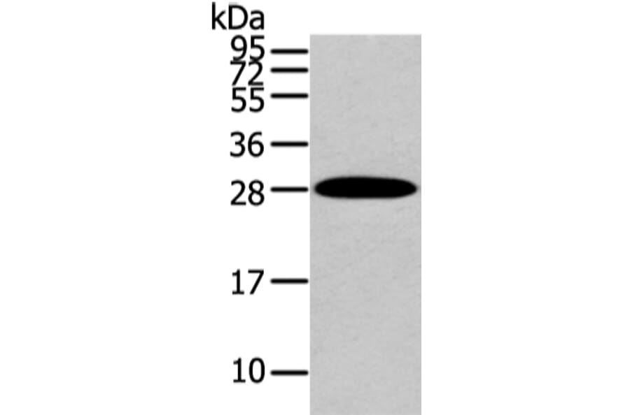 ZNF365 Antibody from Signalway Antibody (43441) - Antibodies.com