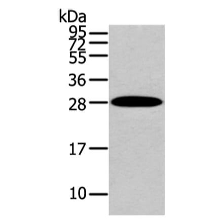ZNF365 Antibody from Signalway Antibody (43441) - Antibodies.com