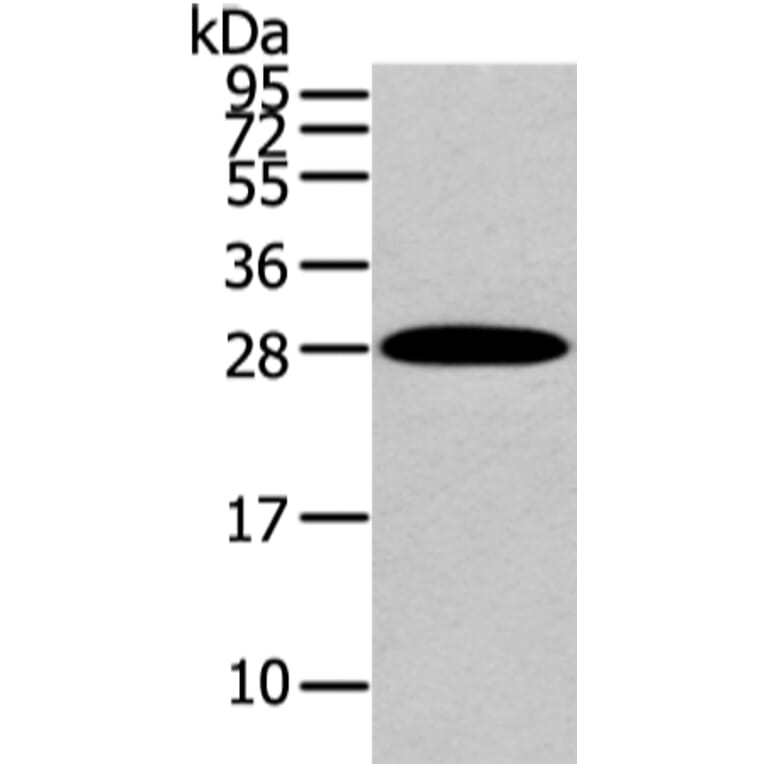 ZNF365 Antibody from Signalway Antibody (43441) - Antibodies.com
