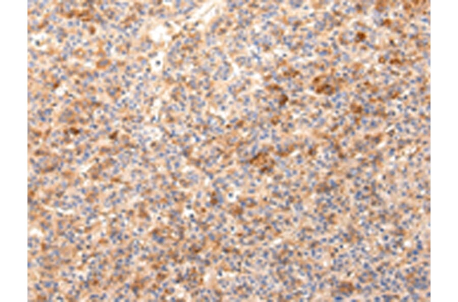 Immunohistochemistry - ZNF365 Antibody from Signalway Antibody (43441) - Antibodies.com