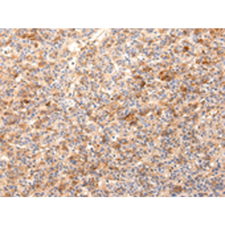 Immunohistochemistry - ZNF365 Antibody from Signalway Antibody (43441) - Antibodies.com