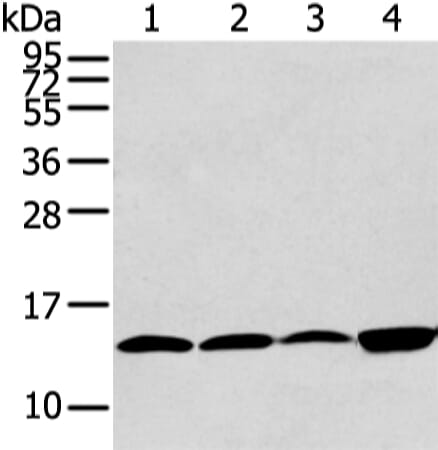 Gel: 12% SDS-PAGE Lysate: 40 &#956;g Lane 1-4: Hela, 293T, PC3 and TM4 cell Primary antibody: 1/400 dilution Secondary antibody: Goat anti rabbit IgG at 1/8000 dilution Exposure time: 30 seconds