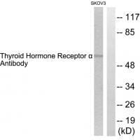 Western blot analysis of extracts from SKOV3 cells, using Thyroid Hormone Receptor &#945; antibody #33501.
