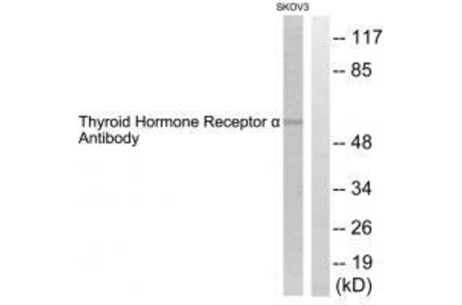 Western blot - Thyroid Hormone Receptor α Antibody from Signalway Antibody (33501) - Antibodies.com