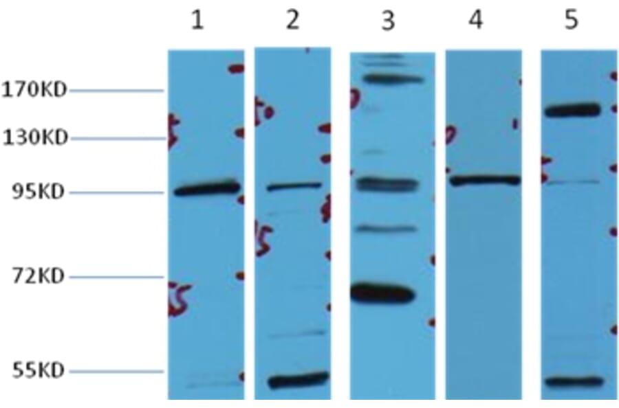 Western blot - β-Catenin Mouse Monoclonal Antibody from Signalway Antibody (38020) - Antibodies.com