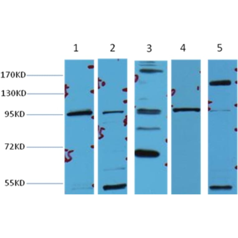 Western blot - β-Catenin Mouse Monoclonal Antibody from Signalway Antibody (38020) - Antibodies.com