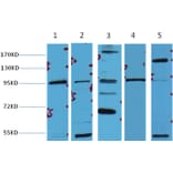 Western blot - β-Catenin Mouse Monoclonal Antibody from Signalway Antibody (38020) - Antibodies.com
