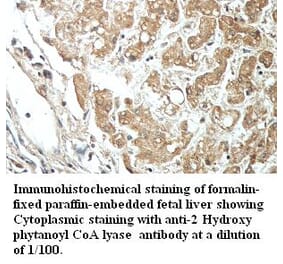 2-hydroxyacyl-CoA lyase 1 Antibody from Signalway Antibody (39416) - Antibodies.com