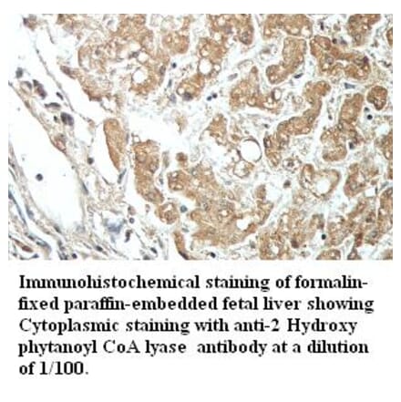 2-hydroxyacyl-CoA lyase 1 Antibody from Signalway Antibody (39416) - Antibodies.com