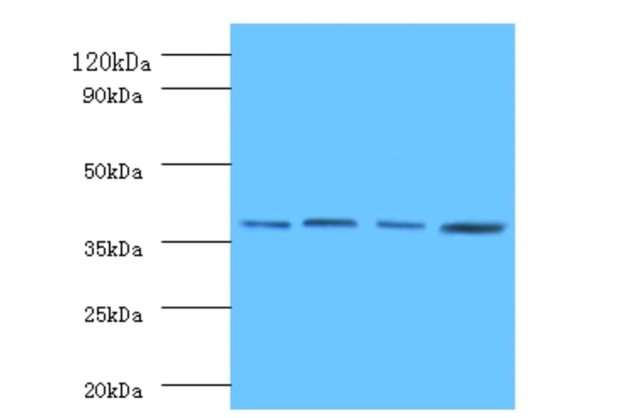 Protein FAM110B Polyclonal Antibody from Signalway Antibody (42164) - Antibodies.com