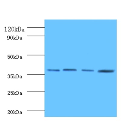 Protein FAM110B Polyclonal Antibody from Signalway Antibody (42164) - Antibodies.com