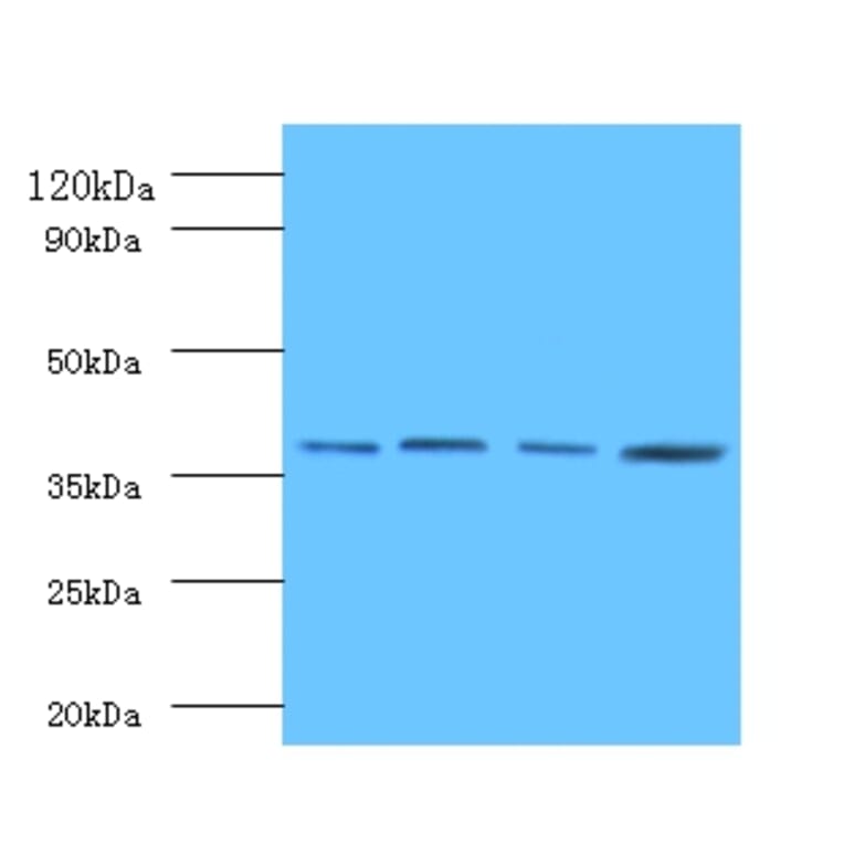 Protein FAM110B Polyclonal Antibody from Signalway Antibody (42164) - Antibodies.com