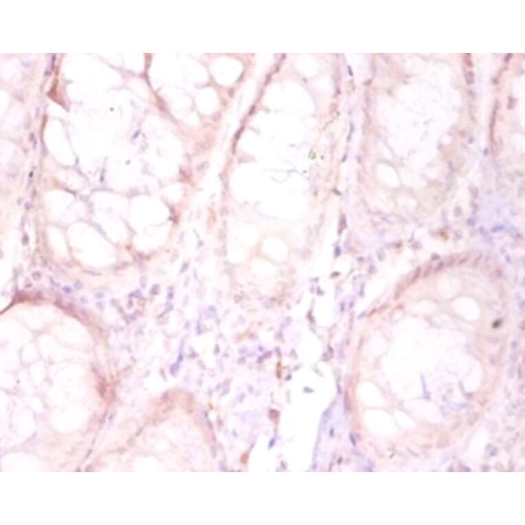Immunohistochemistry - Protein FAM110B Polyclonal Antibody from Signalway Antibody (42164) - Antibodies.com