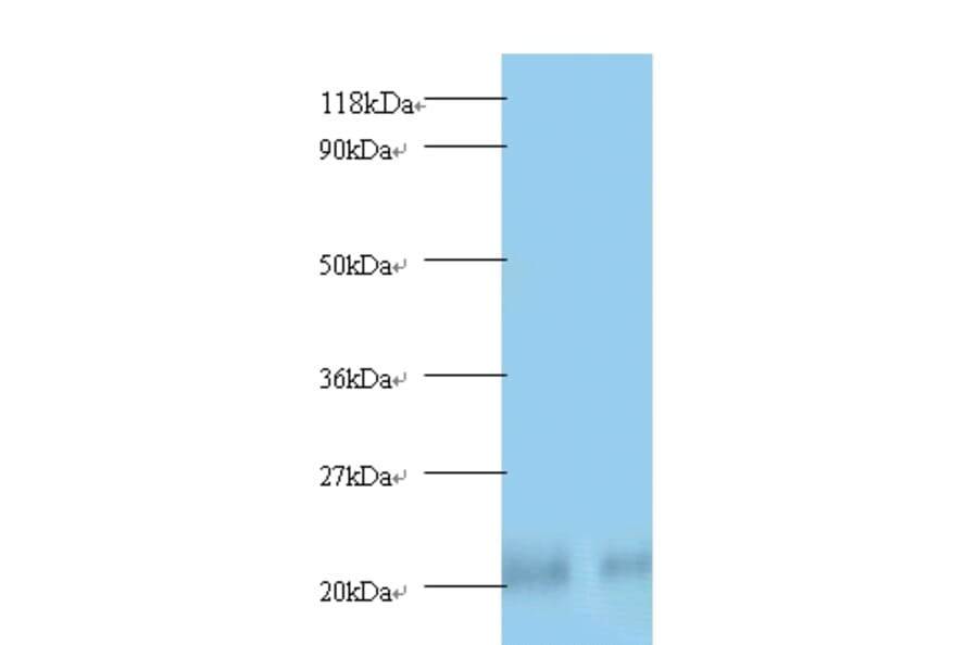Peroxiredoxin-1 Polyclonal Antibody from Signalway Antibody (42222) - Antibodies.com
