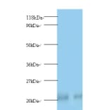 Peroxiredoxin-1 Polyclonal Antibody from Signalway Antibody (42222) - Antibodies.com