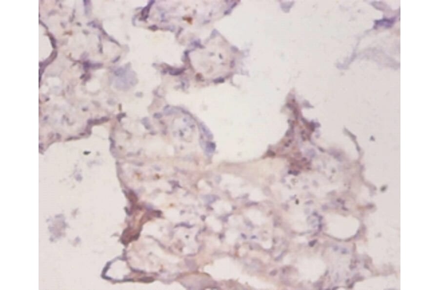 Immunohistochemistry - Peroxiredoxin-1 Polyclonal Antibody from Signalway Antibody (42222) - Antibodies.com