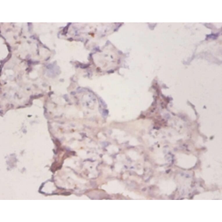 Immunohistochemistry - Peroxiredoxin-1 Polyclonal Antibody from Signalway Antibody (42222) - Antibodies.com