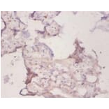 Immunohistochemistry - Peroxiredoxin-1 Polyclonal Antibody from Signalway Antibody (42222) - Antibodies.com