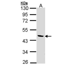 BCAT2 antibody from Signalway Antibody (22010) - Antibodies.com