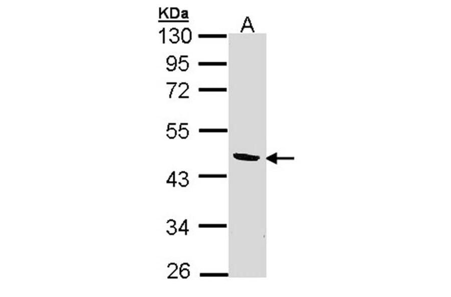 BCAT2 antibody from Signalway Antibody (22010) - Antibodies.com