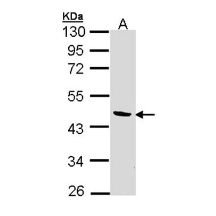 BCAT2 antibody from Signalway Antibody (22010) - Antibodies.com