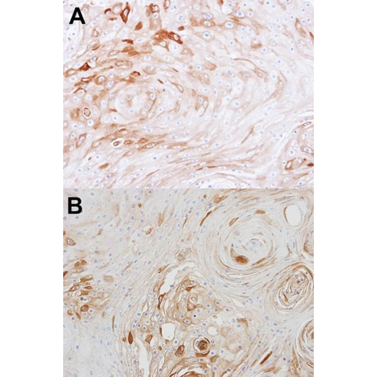 Immunohistochemistry - BCAT2 antibody from Signalway Antibody (22010) - Antibodies.com