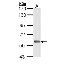 IFIT3 antibody from Signalway Antibody (22040) - Antibodies.com
