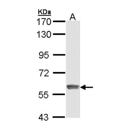 IFIT3 antibody from Signalway Antibody (22040) - Antibodies.com