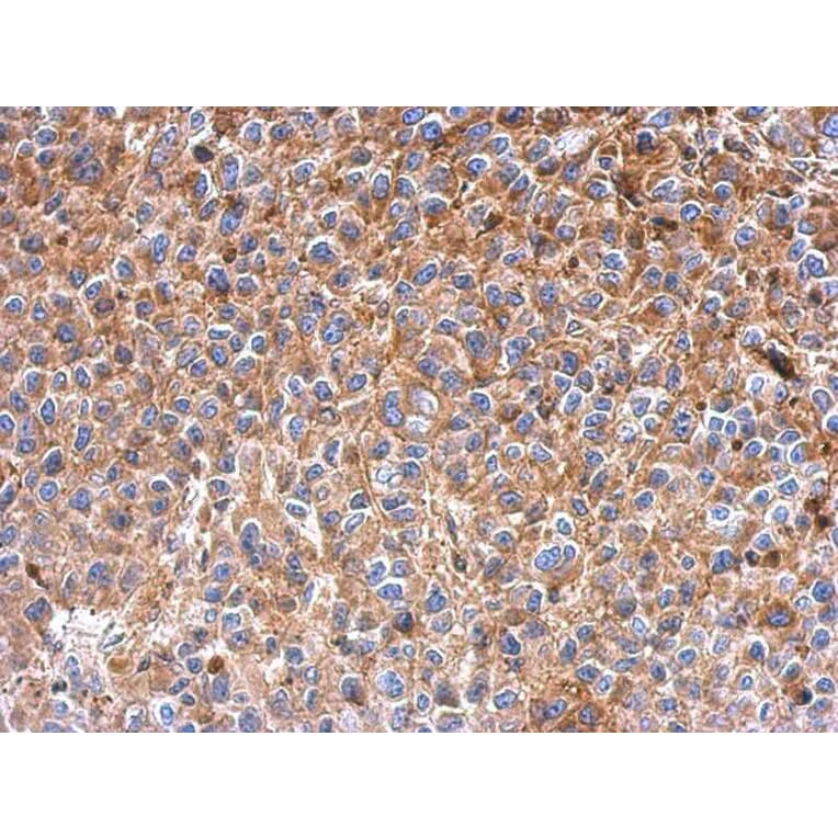 Immunohistochemistry - IFIT3 antibody from Signalway Antibody (22040) - Antibodies.com