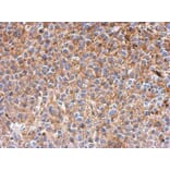 Immunohistochemistry - IFIT3 antibody from Signalway Antibody (22040) - Antibodies.com