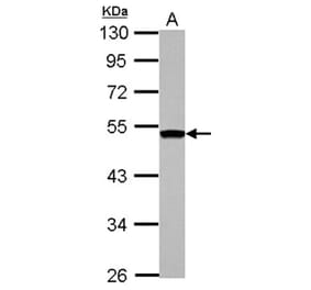 DGAT2 antibody from Signalway Antibody (22070) - Antibodies.com