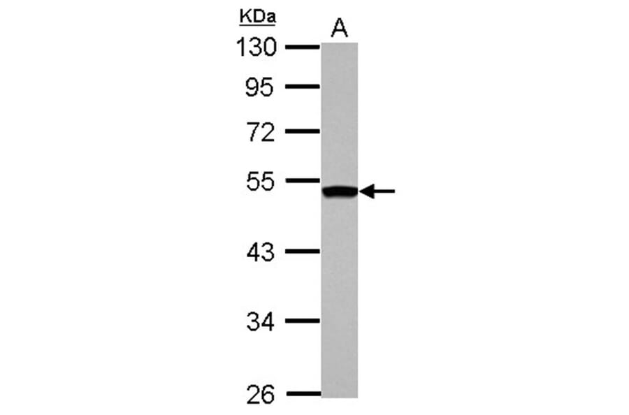 DGAT2 antibody from Signalway Antibody (22070) - Antibodies.com