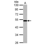 DGAT2 antibody from Signalway Antibody (22070) - Antibodies.com