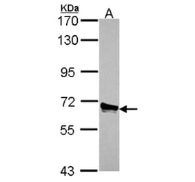 ACOX3 antibody from Signalway Antibody (22136) - Antibodies.com