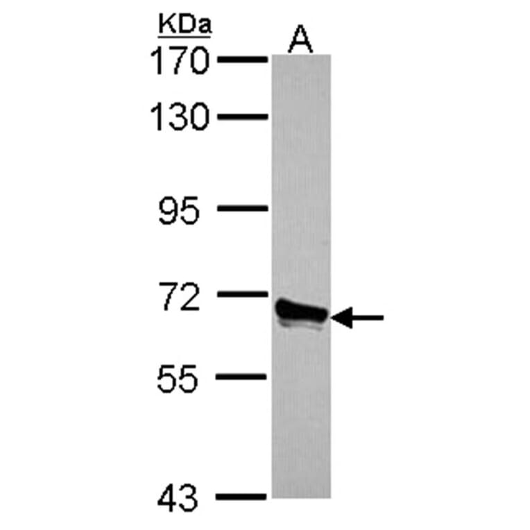 ACOX3 antibody from Signalway Antibody (22136) - Antibodies.com