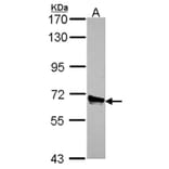 ACOX3 antibody from Signalway Antibody (22136) - Antibodies.com