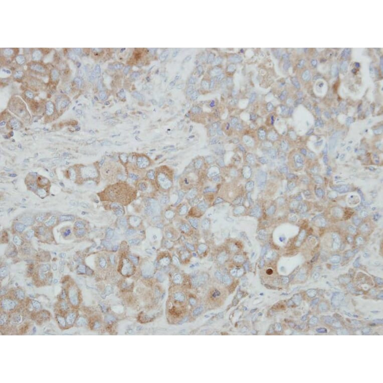 Immunohistochemistry - ACOX3 antibody from Signalway Antibody (22136) - Antibodies.com