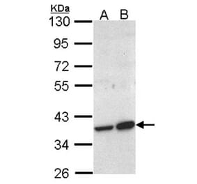 ACMSD antibody from Signalway Antibody (22144) - Antibodies.com