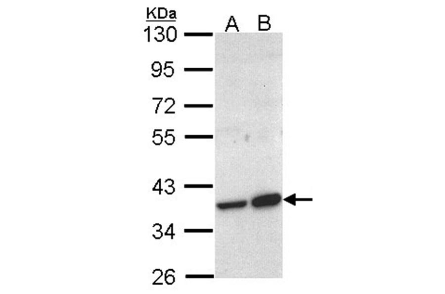 ACMSD antibody from Signalway Antibody (22144) - Antibodies.com