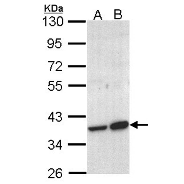 ACMSD antibody from Signalway Antibody (22144) - Antibodies.com
