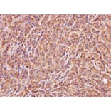 Immunohistochemistry - ACMSD antibody from Signalway Antibody (22144) - Antibodies.com