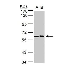 NT5C2 antibody from Signalway Antibody (22148) - Antibodies.com