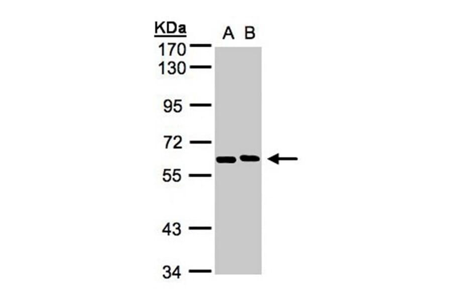 NT5C2 antibody from Signalway Antibody (22148) - Antibodies.com