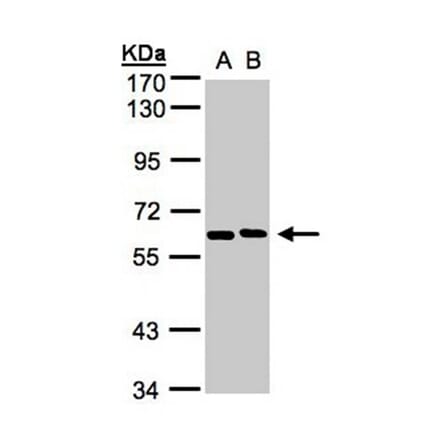 NT5C2 antibody from Signalway Antibody (22148) - Antibodies.com