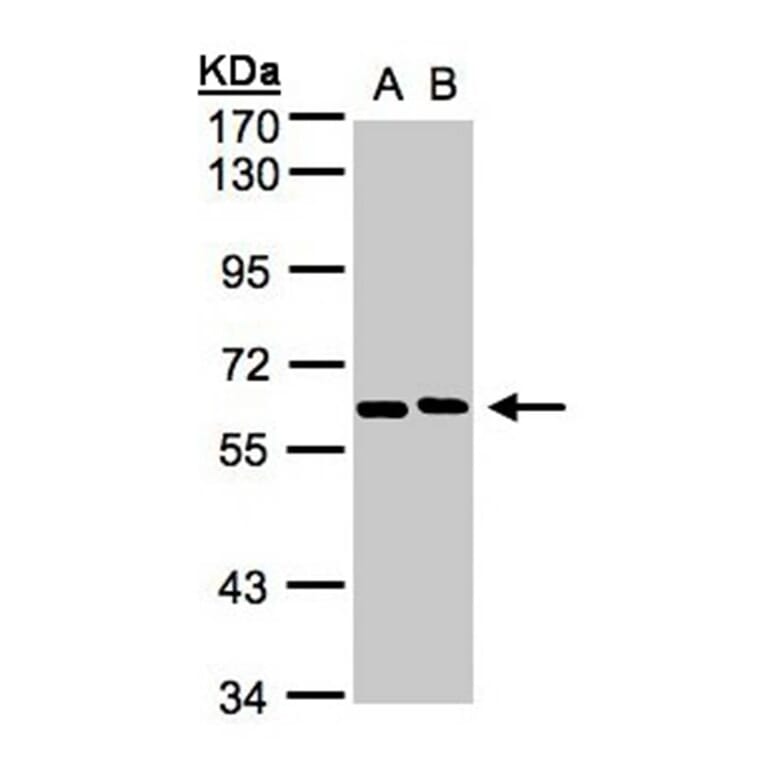 NT5C2 antibody from Signalway Antibody (22148) - Antibodies.com