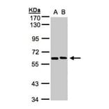 NT5C2 antibody from Signalway Antibody (22148) - Antibodies.com