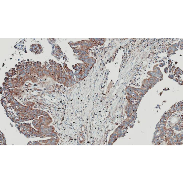 Immunohistochemistry - NT5C2 antibody from Signalway Antibody (22148) - Antibodies.com