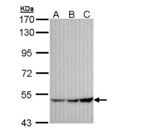 GIRK1 antibody from Signalway Antibody (22167) - Antibodies.com