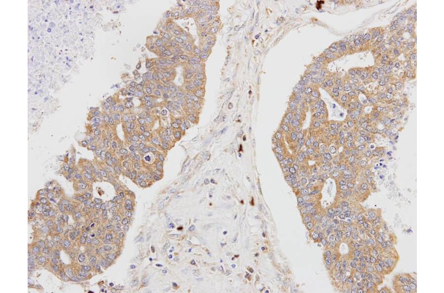 Immunohistochemistry - MSTO1 antibody from Signalway Antibody (22173) - Antibodies.com
