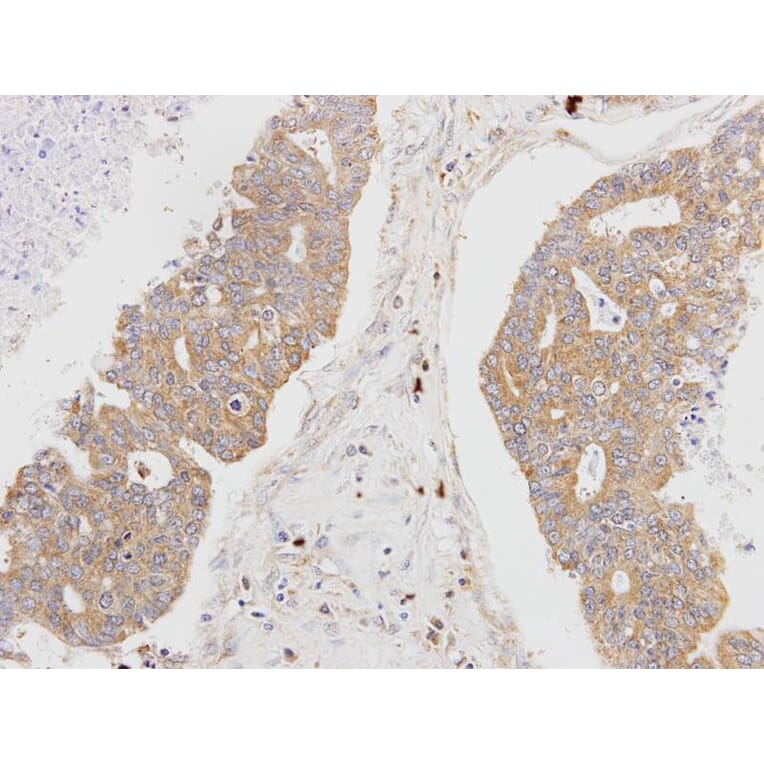 Immunohistochemistry - MSTO1 antibody from Signalway Antibody (22173) - Antibodies.com